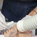 주원개발 | 오로지푸스 남해점(발관리,문제성발톱) 내돈내산 내성발톱교정 후기