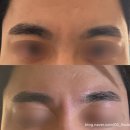 2054 | 사당 남자왁싱 옴므다움 남자왁싱&amp;테라피 눈썹 정리 후 인상 달라진 후기