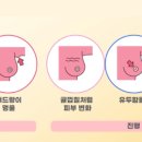 대한유방검진의학회