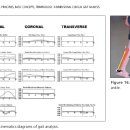The biomechanics of running. normal gait, gait disturbance. 한글 파일 자료 짱 이미지