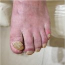 더숲(the 숲) | 안양 범계 무좀발톱 더숲 아버지 발톱 관리 모시고 방문한 후기[The Sup]