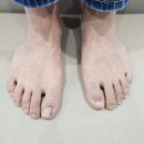 금정약국 | 금정구 내성발톱 무좀치료 불편 없는 케어 후기