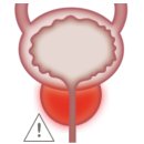 미르비뇨의학과의원 네이버블로그