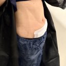 웰리스클리닉동물병원 | 변화가 느껴져 요새 사진 찍을 맛 나는 유라인클리닉 지방분해주사 복부컷주사 후기