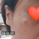 디더블유 | 이지듀 디더블유 이지에프 앰플 후기 2탄!!