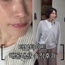 삼성동-17 | 더블타이트 내돈내산 솔직후기 강남 삼성역 삼성동 피부과 추천