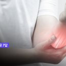 CRPS 복합부위통증증후군 이미지