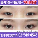 강남현대미학성형외과 Daum카페