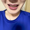 이치덴탈 | 구취제거와 건강한 잇몸을 되찾는 오솔림 시림이치약