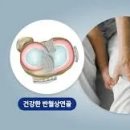 연골 티스토리