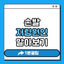 재봉첫걸음A | 손발 저림 원인 알아보기