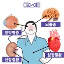 홍택종심혈관리하는내과의원 | 고혈압 심장내과, 모르면 나중에 후회하는 고혈압 관리