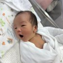 통합셀프자세교정 | 신생아 귀접힘 원인 베이비이어 셀프귀교정 시기 비용 후기