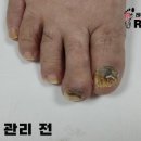 레푸스 사상점 네이버블로그