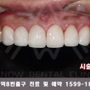 스노우기공소 이미지