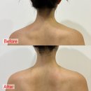 메디소닉 이미지