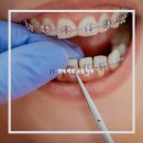 목동웰치과교정과치과의원 | 교정 월 진료의 중요성 교정 치료 중에는 꼭 매달 치과에 가야 하나요?