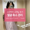 본아뻬띠 | 명동윤곽관리 잘하는곳 스킨피아 JH윤곽술 본아뻬띠 후기
