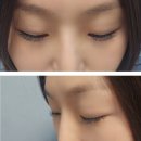 봉자속눈썹 이미지