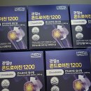 주영식품 | 주영엔에스 콘드로이친 무릎 관절염 섭취 후기 (+관리법)