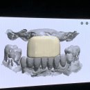 크리스탈치과기공소 이미지