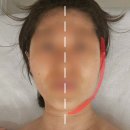 대구 얼굴 경락 잘하는 곳 | 피오레에스테틱, 뱀부작은얼굴 관리 후기