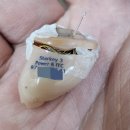 독일 베스트 보청기 이미지