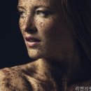 한피부과의원 네이버블로그