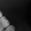 꼬마이치과의원 이미지