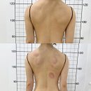 서면 다이어트 블로썸유에서 셀핏 바디관리 등관리 받고 온 솔직후기