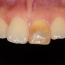 워싱턴치과의원 | 춘천치과잘하는곳? 과잉없이 '정확한' 치료받는 TIP [의사작성]