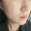 차오름약국 | 콜라겐 탄력 앰플 유쎄라블 2X 볼륨필인 앰플 해골형 볼패임 얼굴형 맞춤 앰플 사용 후기