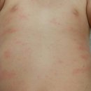 어니스트 동물병원 | 아기 아토피 크림 신생아 피부관리 방법