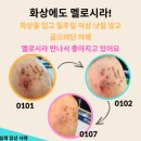 9.20~23 골다공증/체머리/화상/무좀/불면증/백내장/ 변비/췌장암4기 /혈액종양암 등 이미지