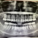 바른손서적문구 | 23.12.04-25 치과, 본식 드레스 투어, 구찌 49재, 청첩장&amp;식권 작업, 크리스마스 연휴(눈썹문신&amp;비니...