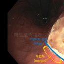 메트로속내과의원 이미지