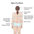 [W166] 내 아이 척추, 괜찮은 걸까요? | Alignlab Chiropractic 이미지