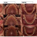 바른이예쁜이치과의원 이미지