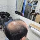 헤어로로