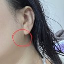 멍글몽글 | 대구피부과 팔자주름 콜라겐 미희주사 내돈내산 후기