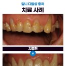 휴먼시아치과의원 이미지