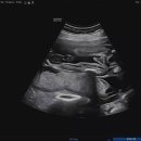 청아여성의원 이미지