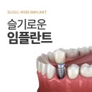 슬기로운치과의원 네이버블로그