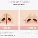 매부리코수술 강남성형외과 바노바기 후기 좋던데요?