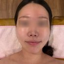 주식회사 라인에너지고양 | 예신관리 일산 피부관리 에너지테라피 극락 느끼고 온 후기_턴업에스테틱