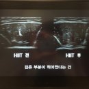 HIIT-FIT 이미지