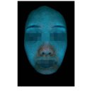 아그네스 | 피지선증식증 치료 아그네스레이저 가격 후기