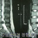 강남챔피언정형외과의원 이미지