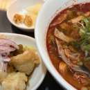 신촌다인치과병원 | 마지막 사랑니... 잘가라... 신촌 잎사귀치과병원 후기~