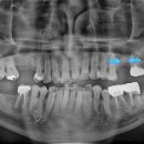 서울석치과의원 이미지